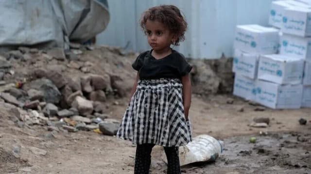 الأمم المتحدة: الجوع والنزوح يفاقمان معاناة أطفال اليمن