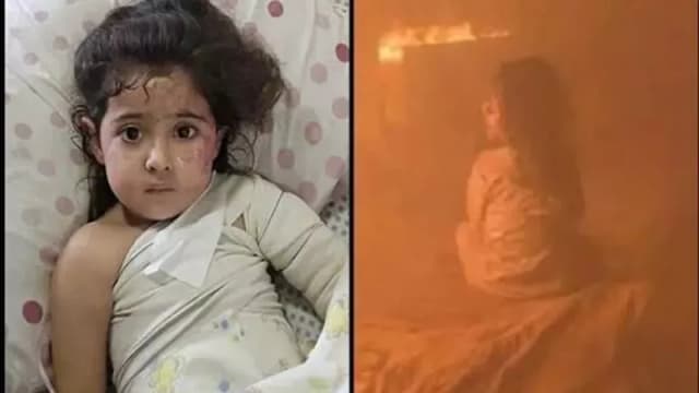 مريم غانم.. طفلة نجت من النيران وفقدت والديها في غزة