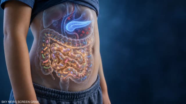 هل تنبئ بكتيريا الأمعاء بسكري الأطفال؟