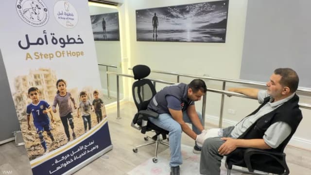 برعاية إماراتية.. تركيب أطراف اصطناعية لـ42 فلسطينيا