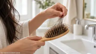 شعرك يتساقط ووجهك شاحب.. هل السبب نقص الحديد؟