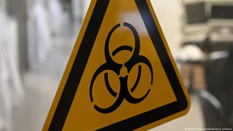 اشتباه في إصابة الطاعون الرئوي في سيبيريا.. ماذا نعرف عن هذا النوع من الطاعون؟
