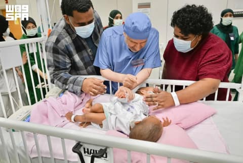 بدء عملية فصل التوأم الملتصق الفيجي «جسبيلي وديسيسيا» بالرياض