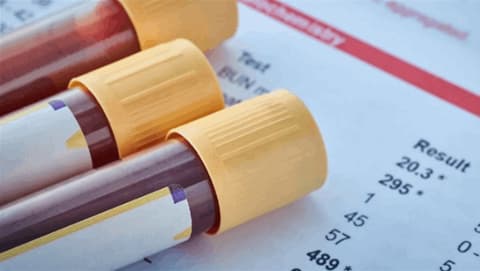 تقنية جينية جديدة تختصر تشخيص أورام الدماغ إلى أقل من ساعتين