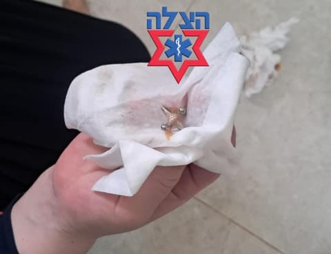 בני ברק: פעוטה כבת שנתיים נחנקה ממשחק "ג'אקס" וניצלה הודות לתושיית חובש