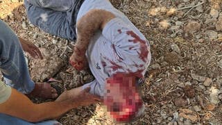 "מתנחלים תקפו עם אלות": פלסטיני בן 50 תועד מדמם במסיק הזיתים