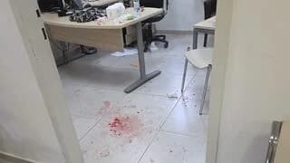 סיוט במרפאה: פסיכיאטר הותקף בראשו ונדקר במפתח שבדי, המטפלות הצילו אותו